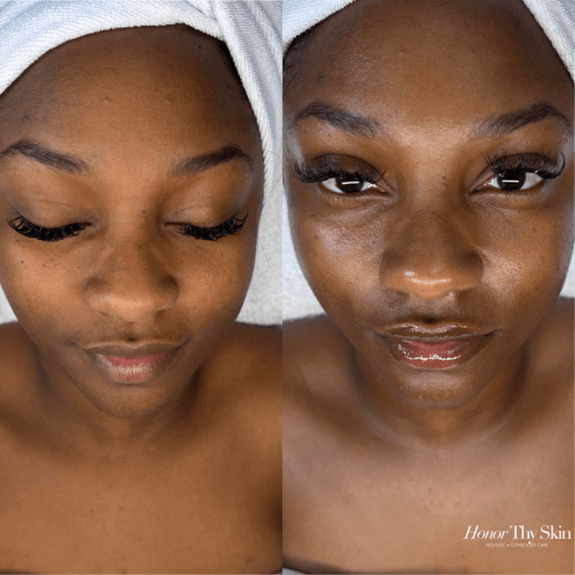 Radiance 4C Series at Honor Thy Skin in Charlotte, NC